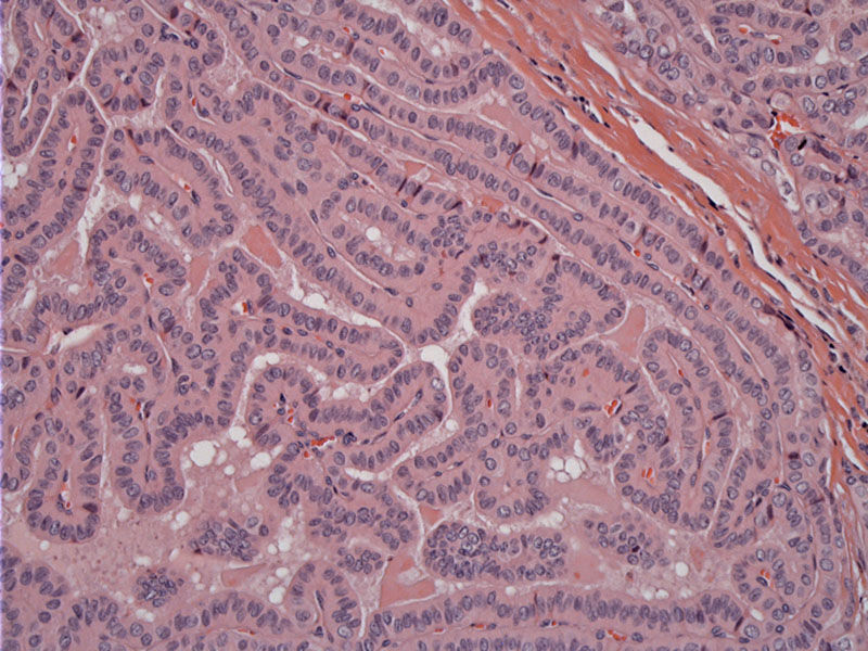Pathology Image